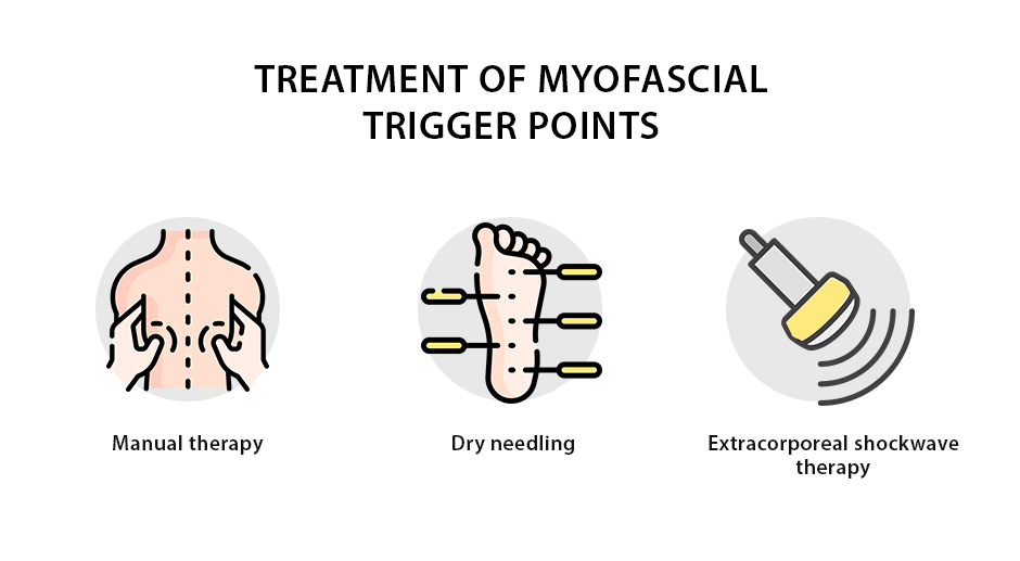 Treatment of Myofascial Trigger Points