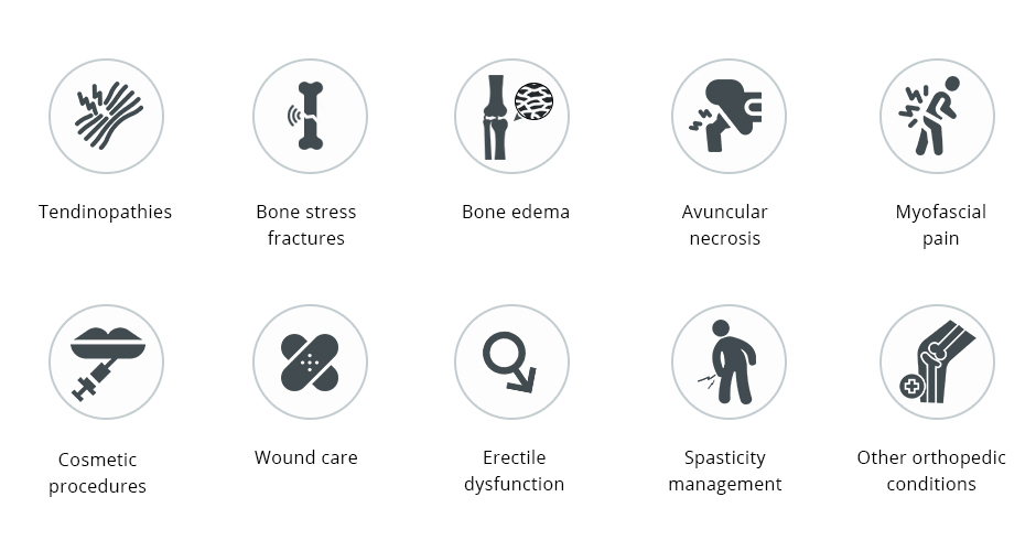 A Brief History of Extracorporeal Shockwave Therapy