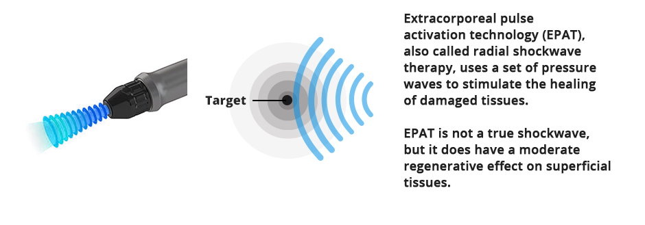 The Effectiveness Of Radial Extracorporeal Shock Wave Therapy In Patie