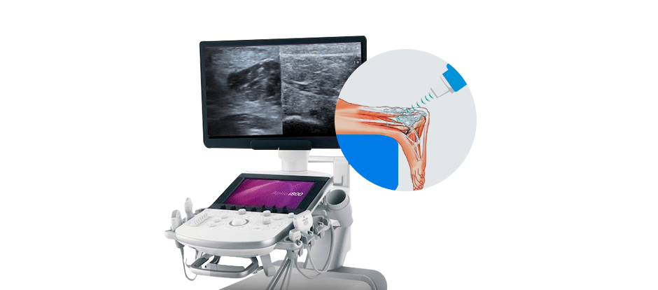 High Resolution Ultrasound Imaging Boosts ESWT Efficacy