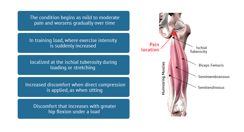 Acute Proximal Hamstring Tendon Avulsions