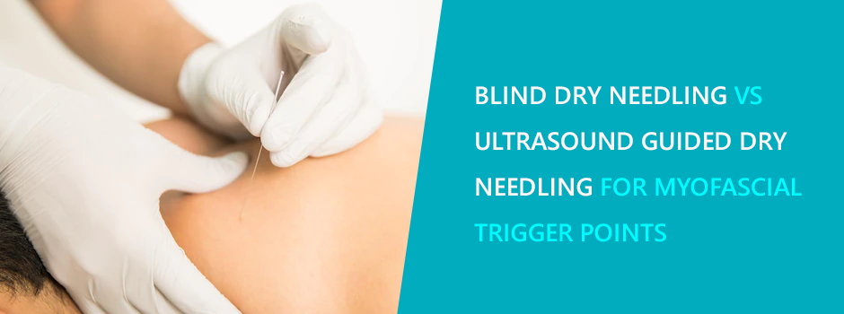 Blind Dry Needling vs Ultrasound Guided Dry Needling for Myofascial Trigger Points