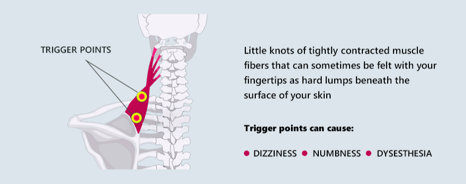 What is Dry Needling?