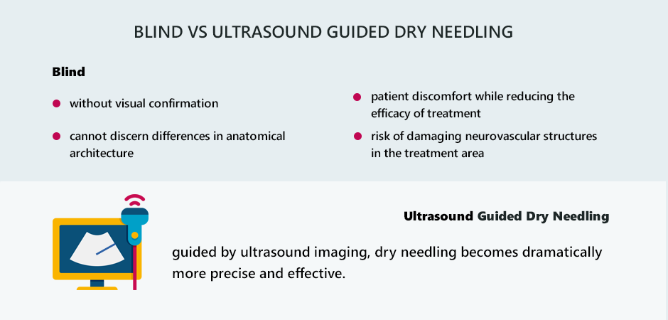 Blind vs Ultrasound Guided Dry Needling