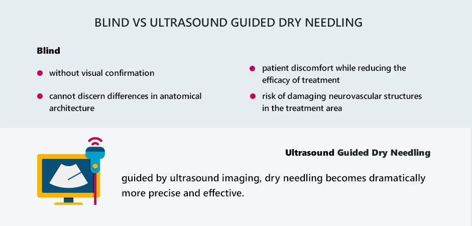 Dry needling / Ultrasound dry needling