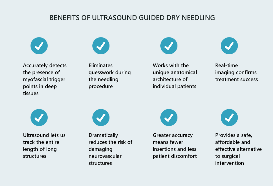 Benefits of Ultrasound Guided Dry Needling