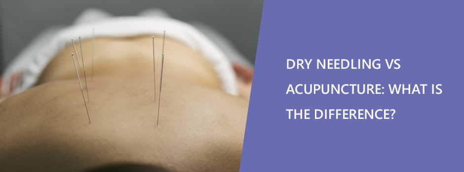 Dry Needling vs Acupuncture: What is the Difference?