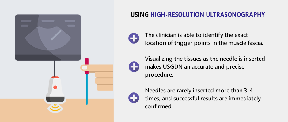 Ultrasound Guided Dry Needling (UGDN)