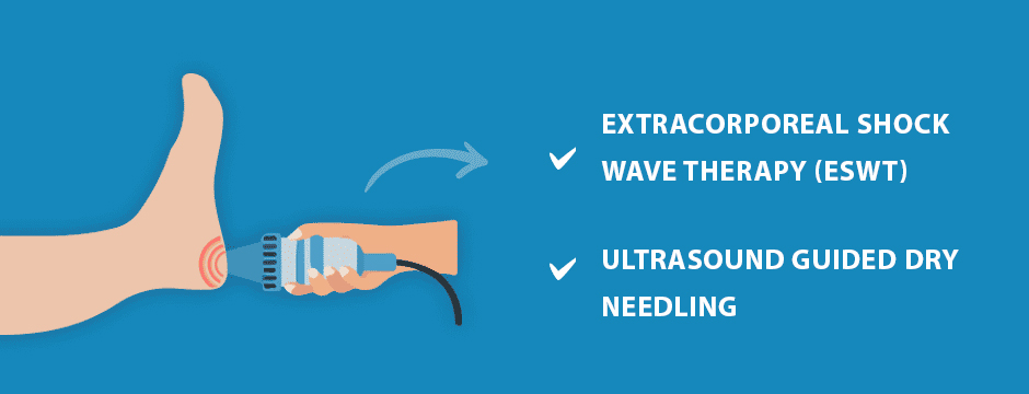 Rehabilitating the Plantar Fascia: Does Stretching Really Help