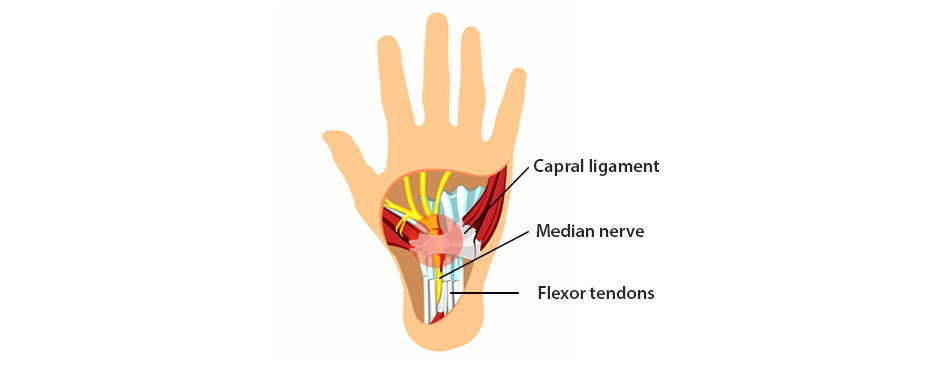 About Carpal Tunnel Syndrome