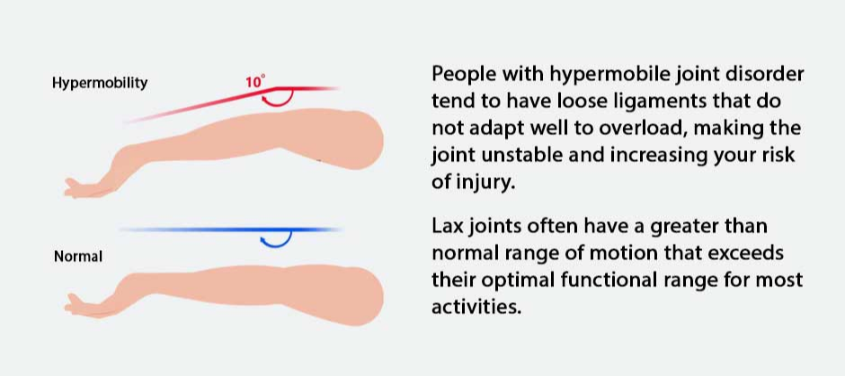 What is Joint Laxity?