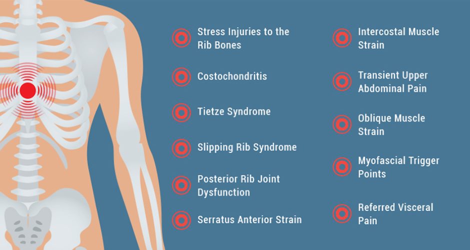 Treating Intercostal Muscle Strain