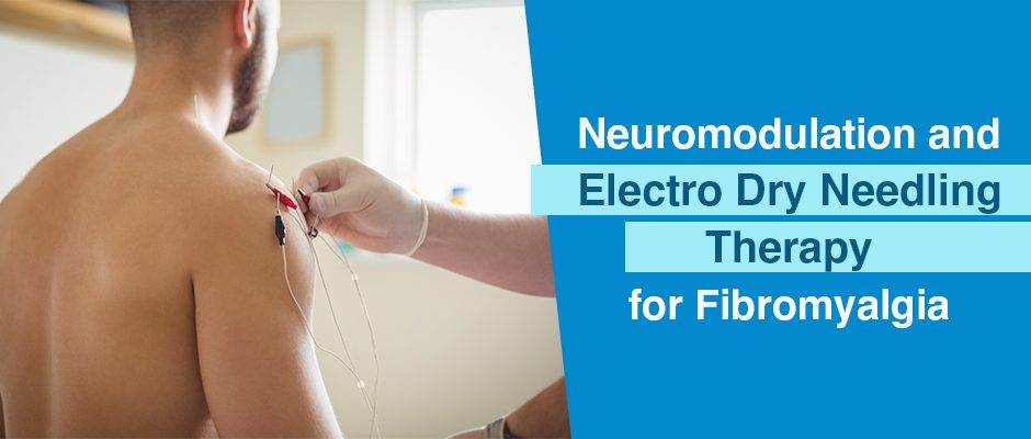 What is Electro-Dry Needling and how can it help with chronic pain and  injury treatment?