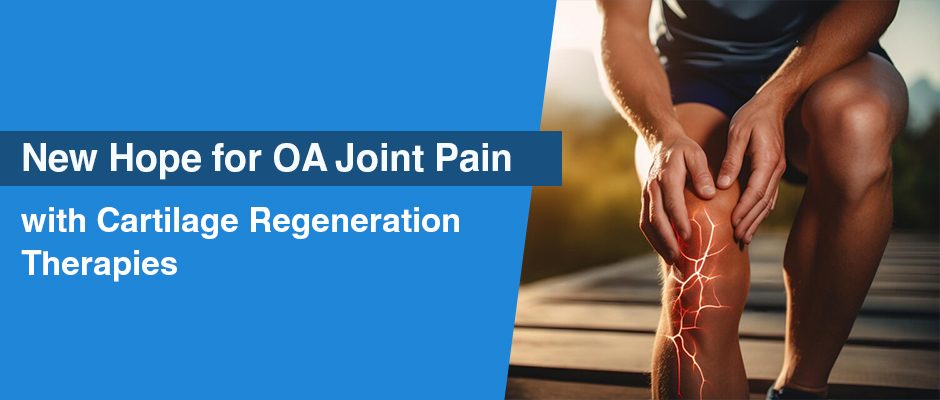 New Hope for OA Joint Pain with Cartilage Regeneration Therapies 