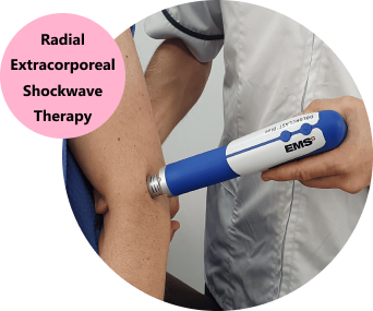 Radial Extracorporeal Shockwave Therapy (ESWT)