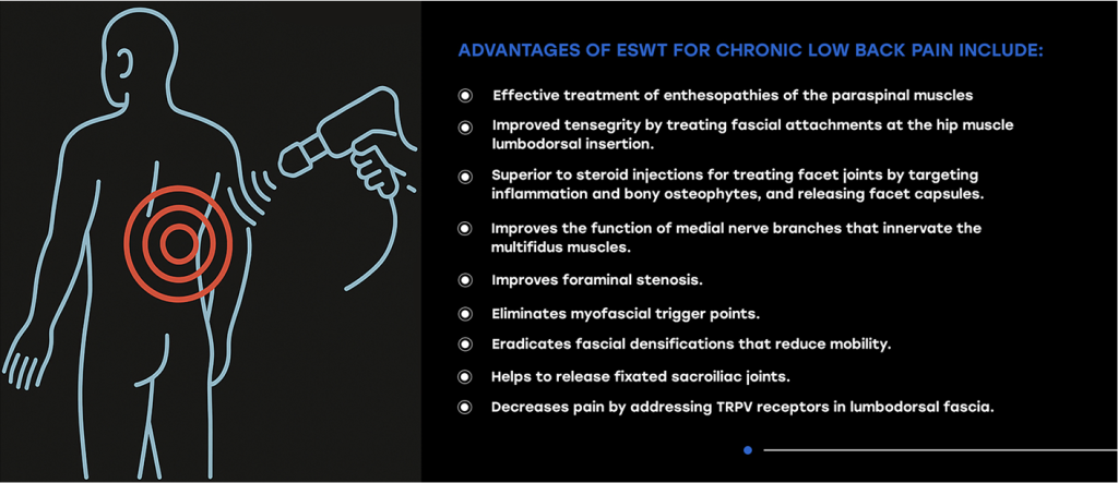 Extracorporeal Shock Wave Therapy for Chronic Low Back Pain - NYDNRehab.com